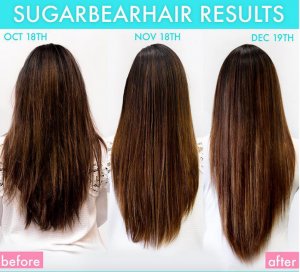 Sugar-Bear-Hair-Vitamins-Review-13-e1471782711299-300x272 Sugar-Bear-Hair-Vitamins-Review-13-e1471782711299
